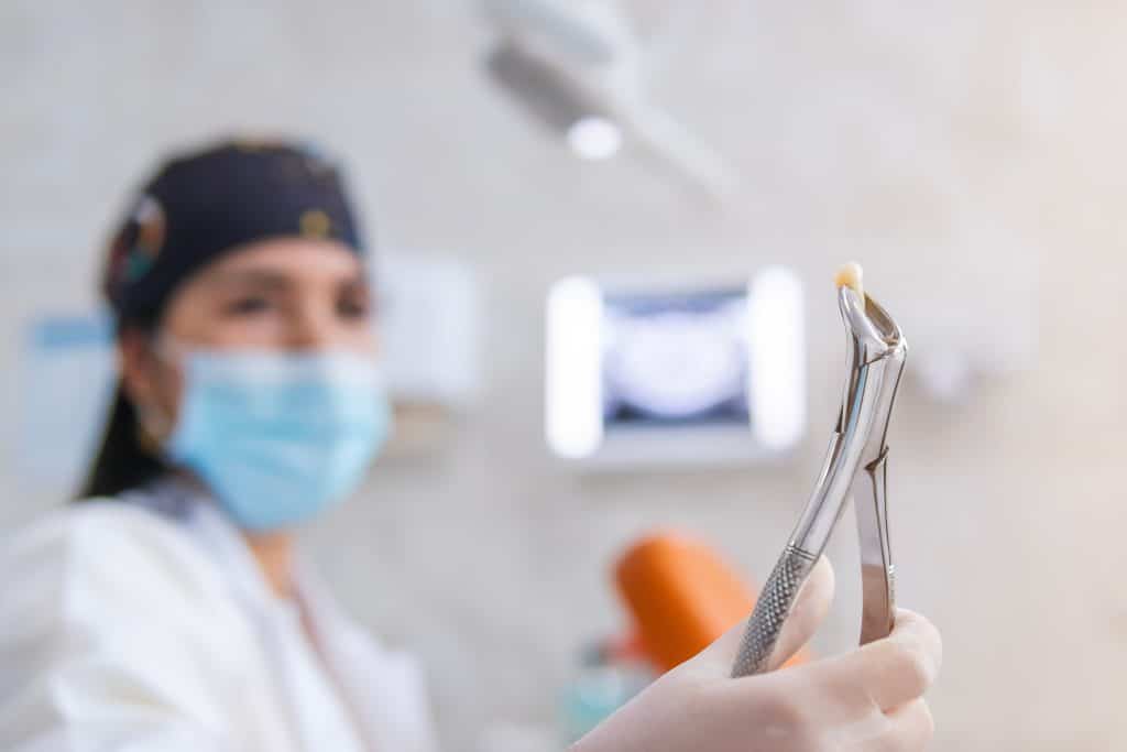 Tooth Extractions Camanche